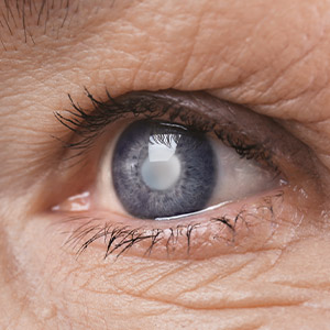 Optometrist in Lynbrook